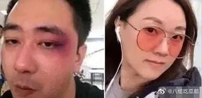 6park Com 网曝知名男星被妻子家暴 扇500个耳光 还用烟头烫